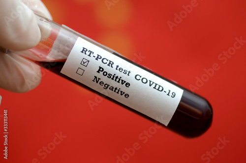 Stock photo of holding tube with Blood Test (novel Coronavirus 2019 disease,COVID-19,nCoV) and flag of China. China virus outbreak.
