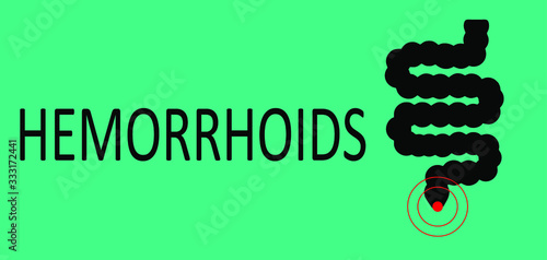 Hemorrhoids vector concept cartoon illustration with man 