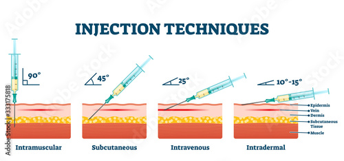 Injection techniques vector illustration. Medical procedure examples scheme photo