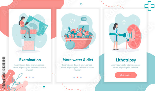 Stages of treatment of urolithiasis.  Onboarding screens template for mobile applications and websites. Flat vector.