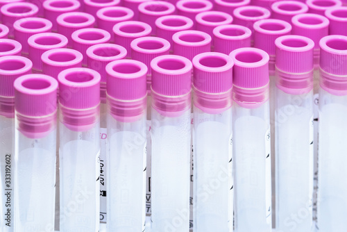 Covid-19 outbreak blood test. Close up view of empty test tubes for blood samples of Coronavirus patients, on a rack .