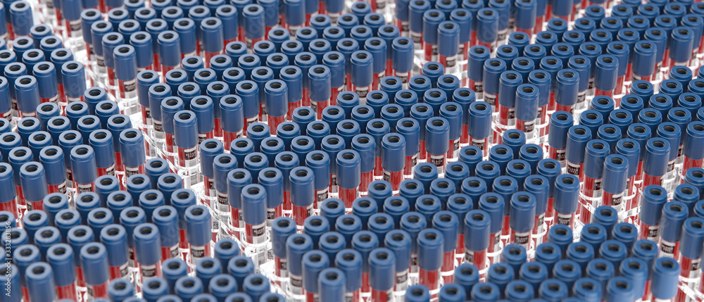 Obraz premium Multiple blood test vials in laboratory holder