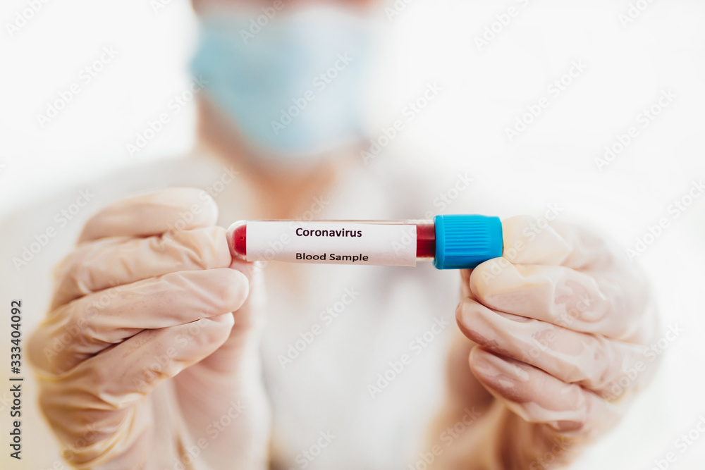 COVID-19 test and laboratory sample of blood testing for diagnosis new Corona virus infection COVID-19 test and laboratory sample of blood testing for diagnosis new Corona virus infection