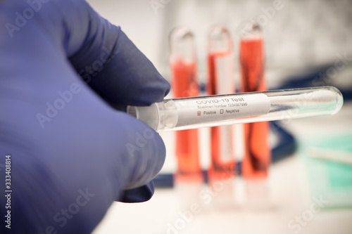 Blood test for COVID-19. Examination of a blood sample for the presence of SARS-CoV-2 coronavirus photo