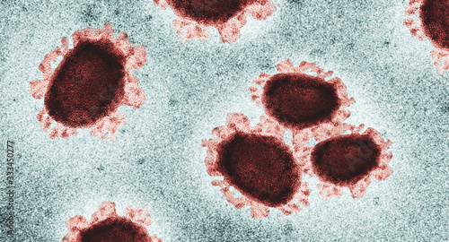 Covid-19, Sars-Cov-2, Coronavirus realistisch unter dem Mikroskop