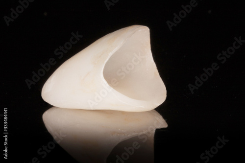 Zahnkrone Veneer aus Vollkeramik