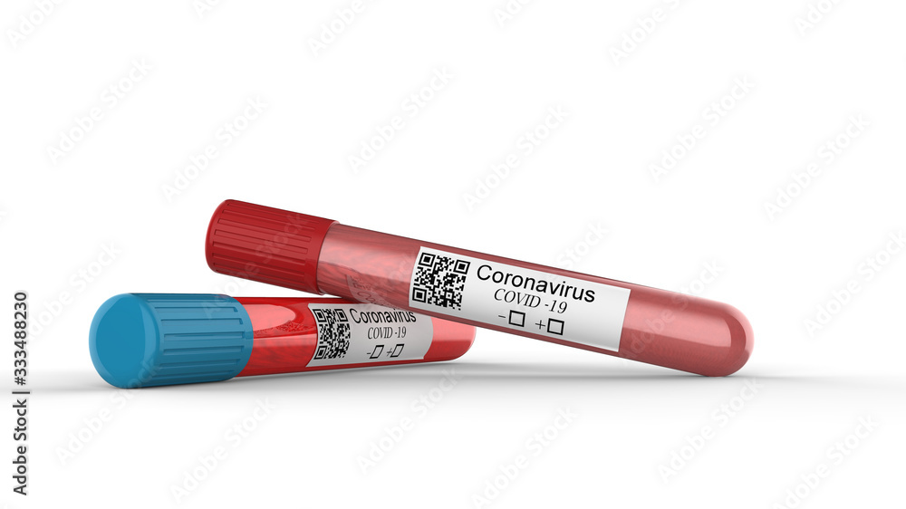 Virus. Corona test. Blood test. 3D rendering.