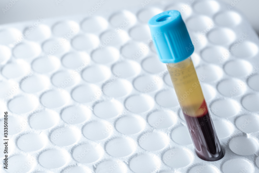 laboratory plasma blood sample analysis laboratory plasma blood sample analysis