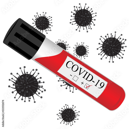 test tube with blood for laboratory, analysis on coronavirus virus infection