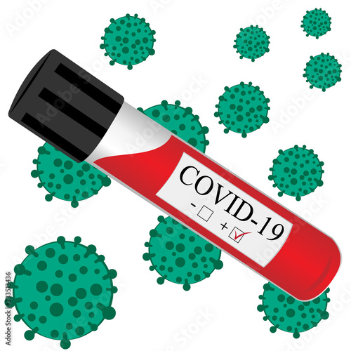test tube with blood for laboratory, analysis on coronavirus virus infection