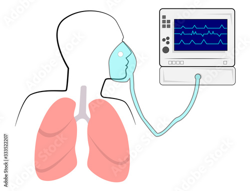 The device of artificial respiration.