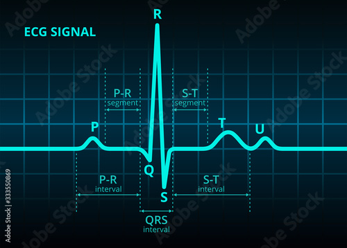 Electrocardiogram ECG or EKG blue heart beat signal pulse monitor oscilloscope