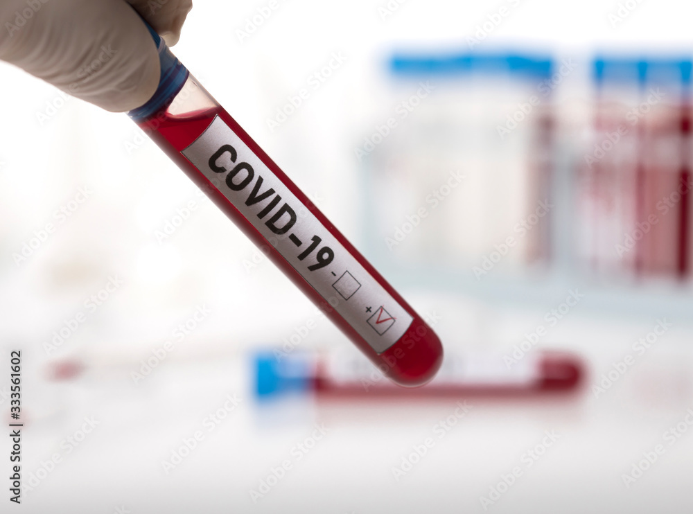 Obraz premium Microbiologist with a tube of biological sample contaminated by Coronavirus with label Covid-19