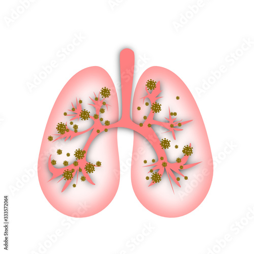 Lung coronavirus