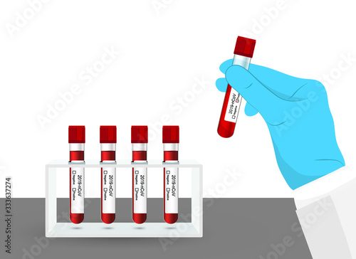 Medical test tubes with blood in rack for 2019-nCoV analyzing.Coronavirus blood test Concept.