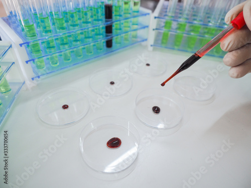 Close up view of a pipette in a researcher's hands dripping a blood sampe in a Petri sish. photo