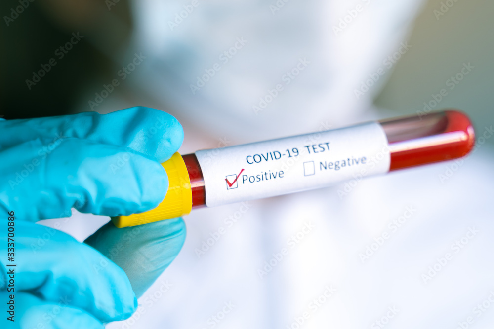 Hand in blue glove holding Test vial with Sample blood test of Coronavirus (Covid-19), Coronavirus Covid 19 infected blood sample. Positive result Hand in blue glove holding Test vial with Sample blood test of Coronavirus (Covid-19), Coronavirus Covid 19 infected blood sample. Positive result