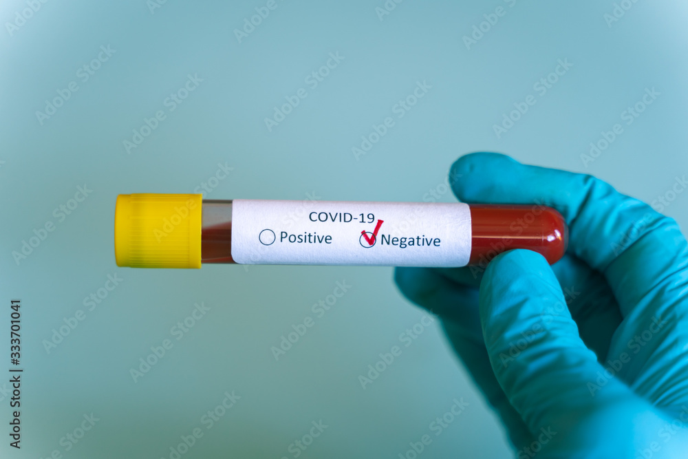 Obraz premium Hand in blue glove holding Test vial with Sample blood test of Coronavirus (Covid-19), Coronavirus Covid 19 infected blood sample. Negative result