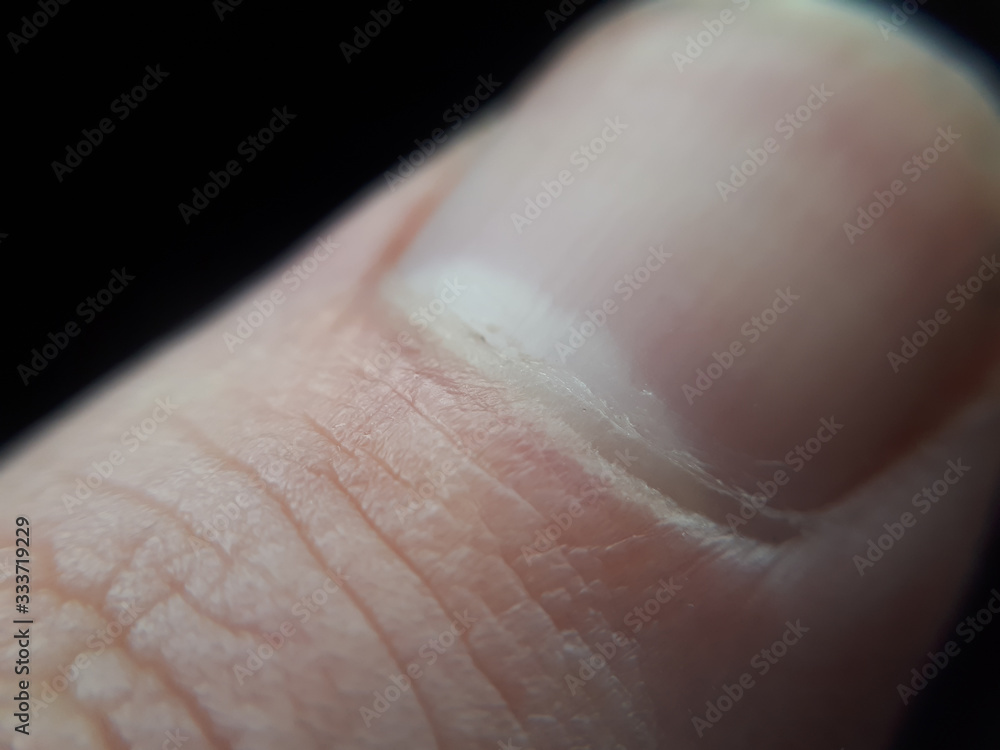 Human finger thumb nail. Healthy man nail macro concept. Human finger thumb nail. Healthy man nail macro concept.