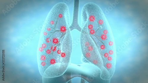 Virus Infection in Respiratory system photo