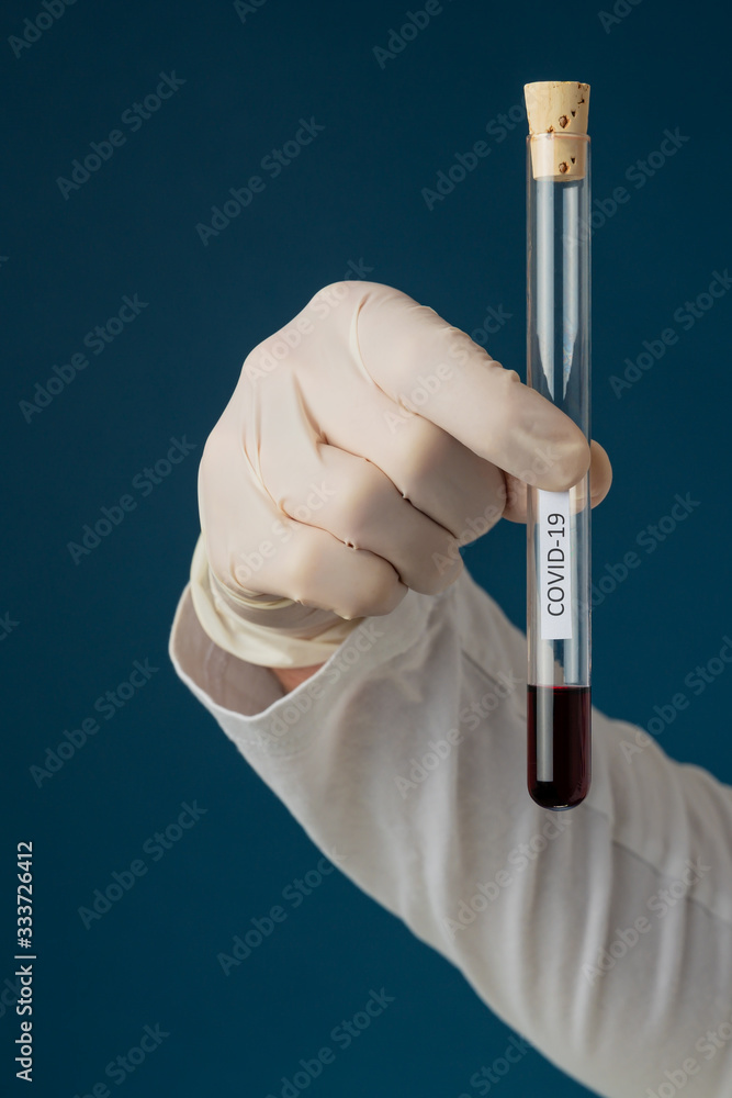 Testing blood sample for new Covid 19 coronavirus Testing blood sample for new Covid 19 coronavirus