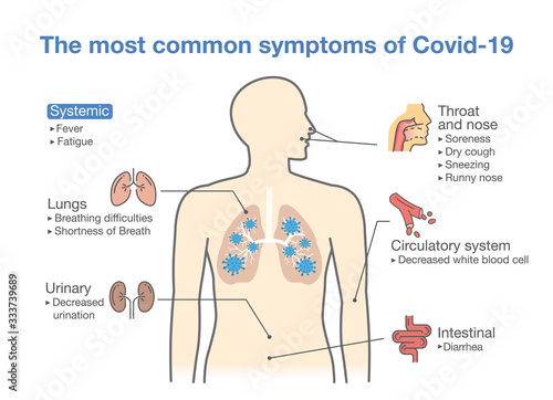 Most common symptoms of Covid-2019 or disease from coronavirus. Illustration about diagram for health check up.
