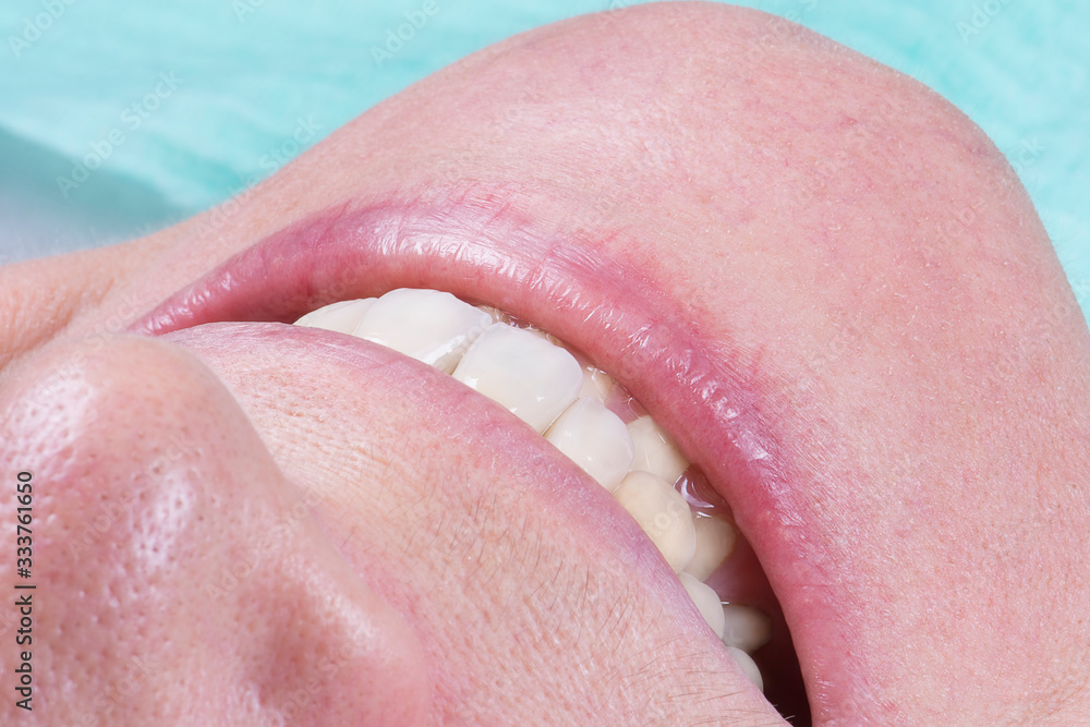 Obraz premium face and teeth