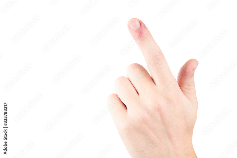 person with finger infection disease. fingernail pain. isolated on white background. copy space person with finger infection disease. fingernail pain. isolated on white background. copy space