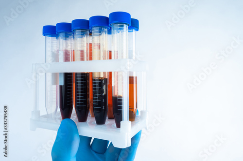 Stand with medical tubes in the hands of a man. Laboratory assistant holds blood donors. Concept - identification of redblood cells in the blood. Identification of blood types in humans. photo