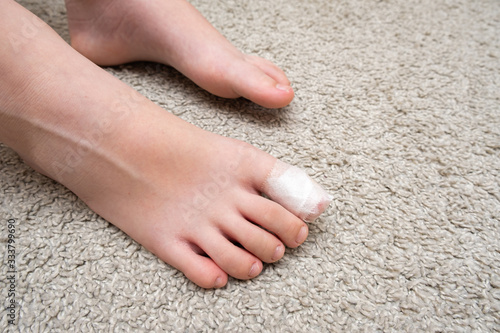 Kid teenager bare foot with a bandage on a toe, wounded toe or ingrown nail first aid