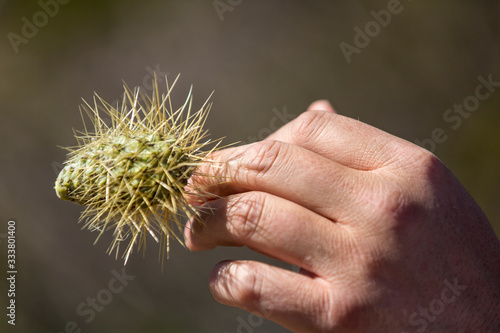 Man with teddy bear cholla cactus stuck in hand photo