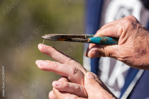 Tableau sur toile Man with teddy bear cholla cactus stuck in hand friend helps remove using pliers