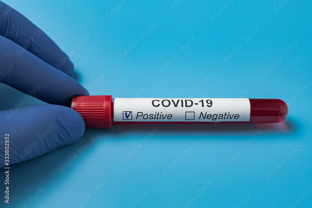 Obraz premium Doctor with tube of biological sample contaminated by Coronavirus. Label Covid-19. Analysis of nCoV 2019