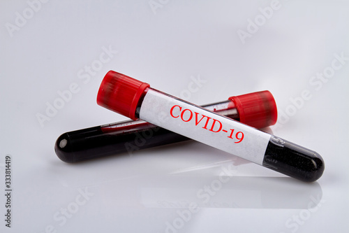 Blood test tubes with COVID-19 virus samples. White reflective table surface. Plasma in research laboratory.
