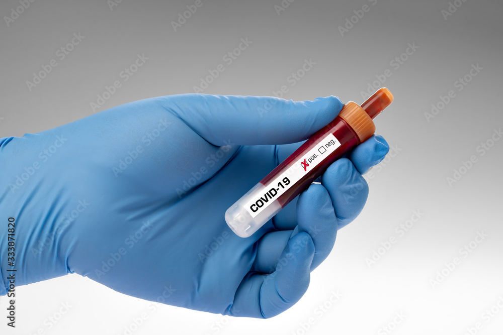 Obraz premium covid-19 - test sample tube with coronavirus in lab