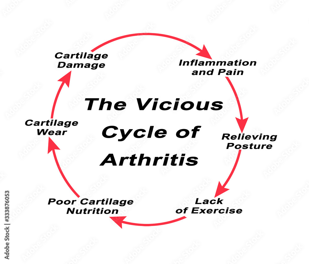 Steps in Vicious Cycle of Arthritis