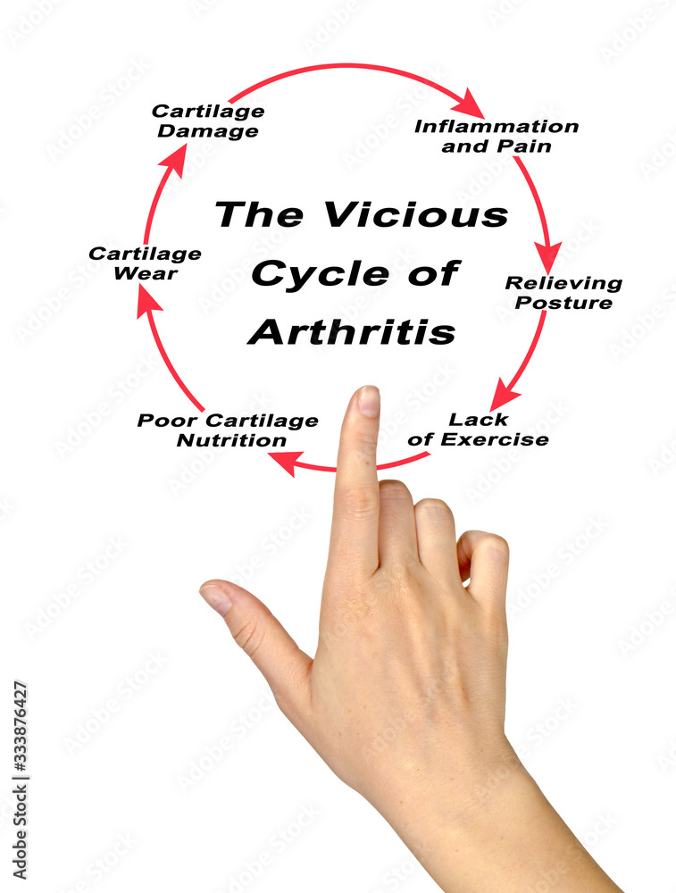 Steps in Vicious Cycle of Arthritis Steps in Vicious Cycle of Arthritis