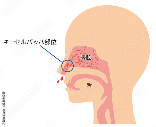 キーゼルバッハ部位 鼻血 構造
