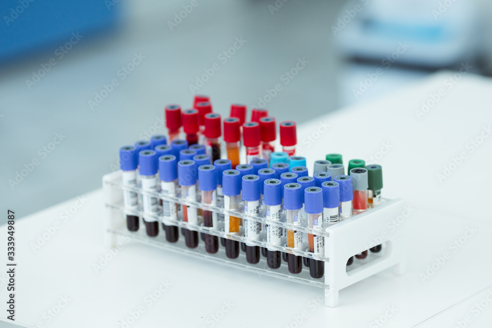Coronavirus blood test concept. Analyzing blood sample in test tube for coronavirus test. Tube with blood for 2019-nCoV or COVID-19 test.
