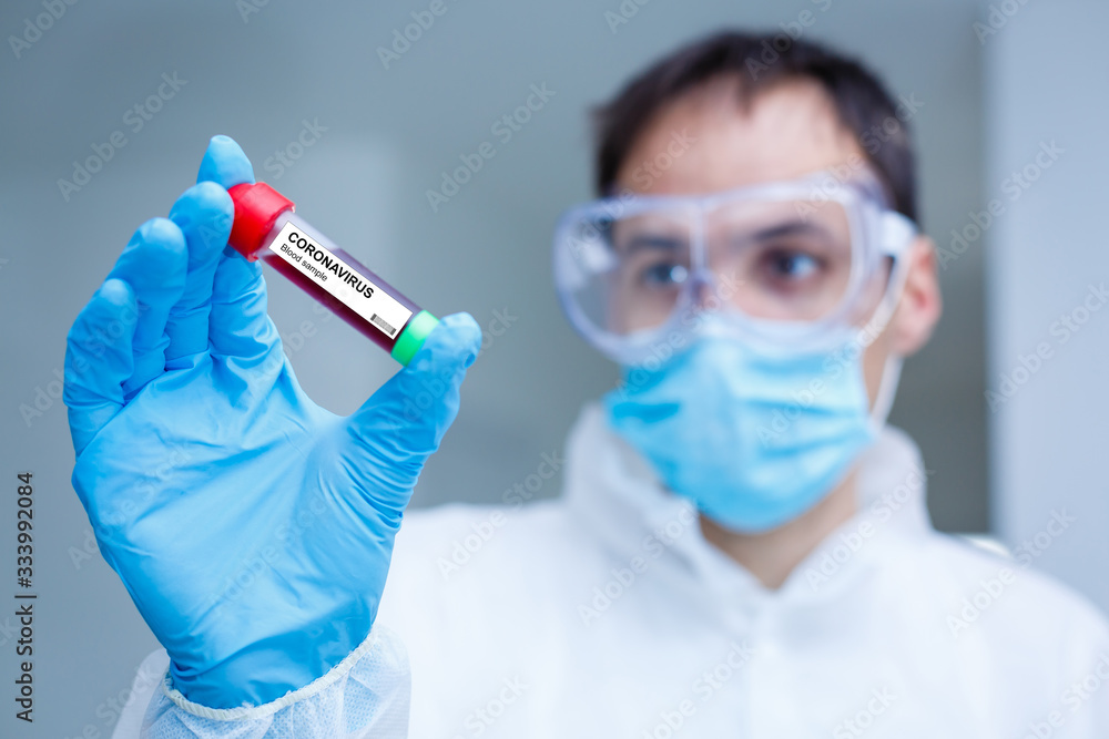 Corona Virus in Lab. Scientist hold Blood Test. New Epidemic Coronavirus 2019 nCoV Corona Virus in Lab. Scientist hold Blood Test. New Epidemic Coronavirus 2019 nCoV