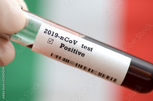 Stock photo of holding tube with Blood Test(novel Coronavirus 2019 disease,COVID-19,nCoV) and Italian flag. Italy virus outbreak.