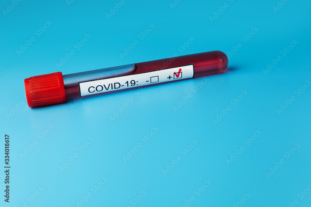 Positive blood test result for the new rapidly spreading Coronavirus Positive blood test result for the new rapidly spreading Coronavirus