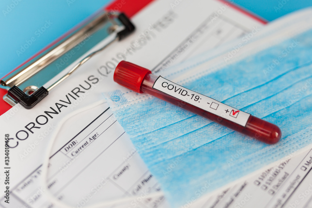 Positive blood test result for the new rapidly spreading Coronavirus Positive blood test result for the new rapidly spreading Coronavirus