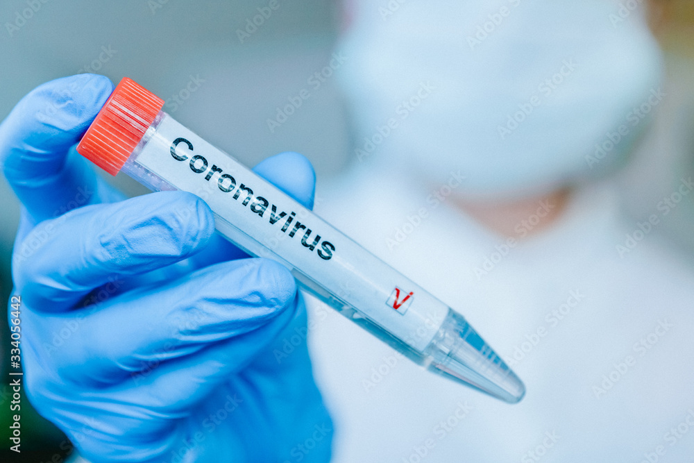 Nurse in a respiratory protective mask and labotator gloves holds a test tube with a positive coronavirus test label. COVID-19 or SARS-CoV-2 diagnostic concept. Nurse in a respiratory protective mask and labotator gloves holds a test tube with a positive coronavirus test label. COVID-19 or SARS-CoV-2 diagnostic concept.