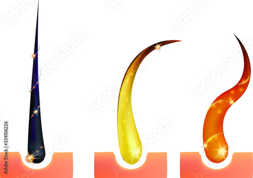 Set of  3d Hair Follicle  different colores (red, brunette, blonde) with vitamins and glowing elements on the creame pink background .Realistic colorful hair folicle with scalps. Vector stock.