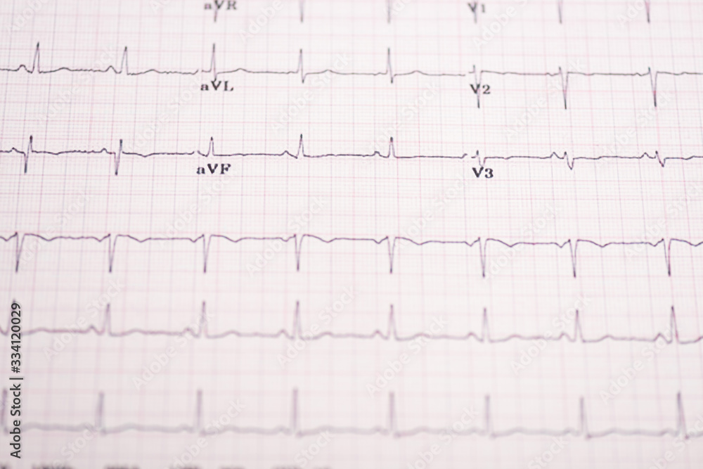 Selective focus of electrocardiogram on paper Selective focus of electrocardiogram on paper