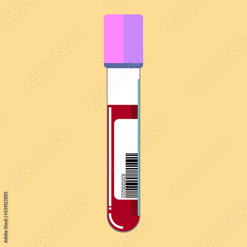 blood sample in test tube