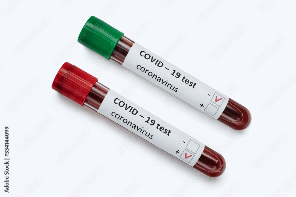 Two laboratory test tubes with blood samples: positive and negative COVID-19 tests, isolated on white background. Coronavirus pandemic concept. Copy space Two laboratory test tubes with blood samples: positive and negative COVID-19 tests, isolated on white background. Coronavirus pandemic concept. Copy space