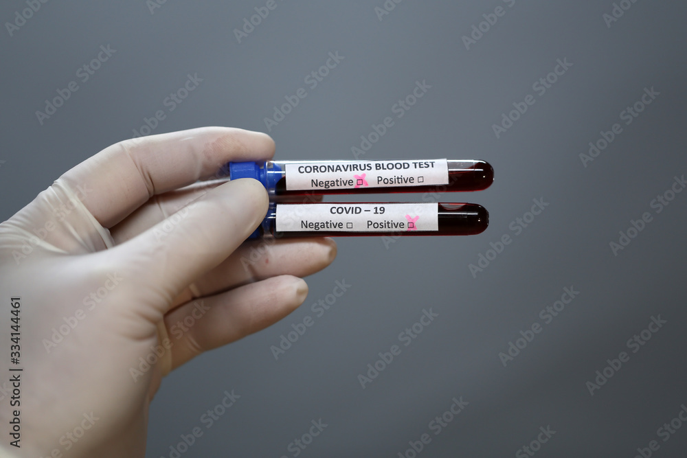Obraz premium Coronavirus testing. A hand holds test tubes with coronavirus results.
