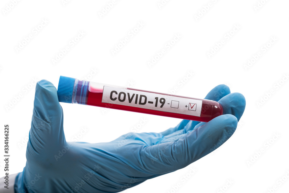 Fototapeta premium Microbiologist with a tube of biological sample contaminated by Coronavirus with label Covid-19